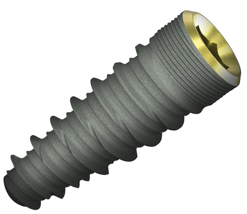 Fusion-angle-large (1)